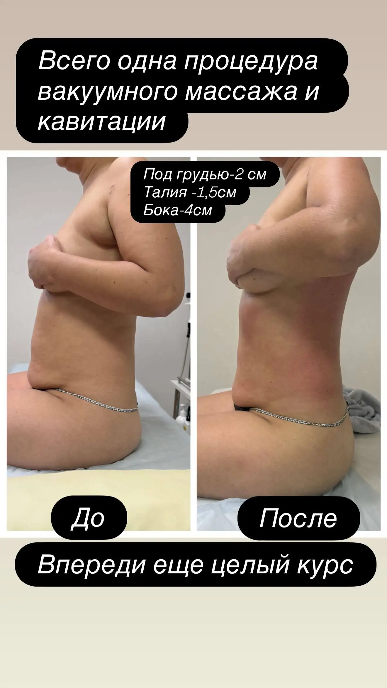 Аппаратный массаж: красота и лёгкость без усилий - Массаж (Услуги) в Чебоксары