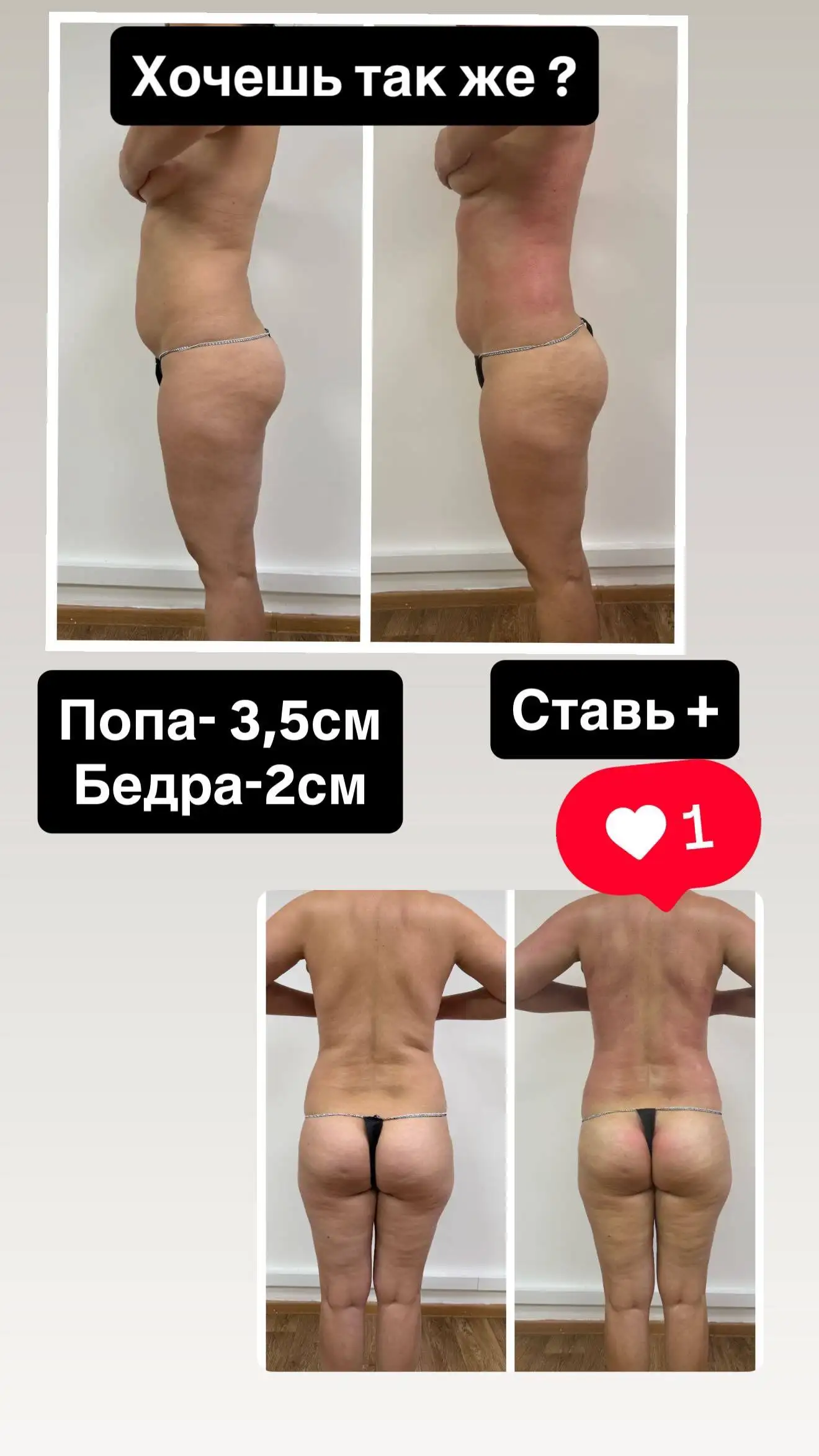 Аппаратный массаж: красота и лёгкость без усилий - Массаж (Услуги) в Чебоксары