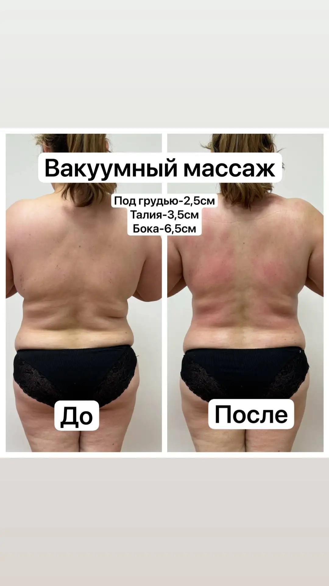 Аппаратный массаж для подтянутого тела - Красота и здоровье (Услуги) в Чебоксары