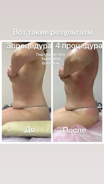 Весеннее преображение: коррекция фигуры и пробные процедуры - Аренда апартаментов в Чебоксары