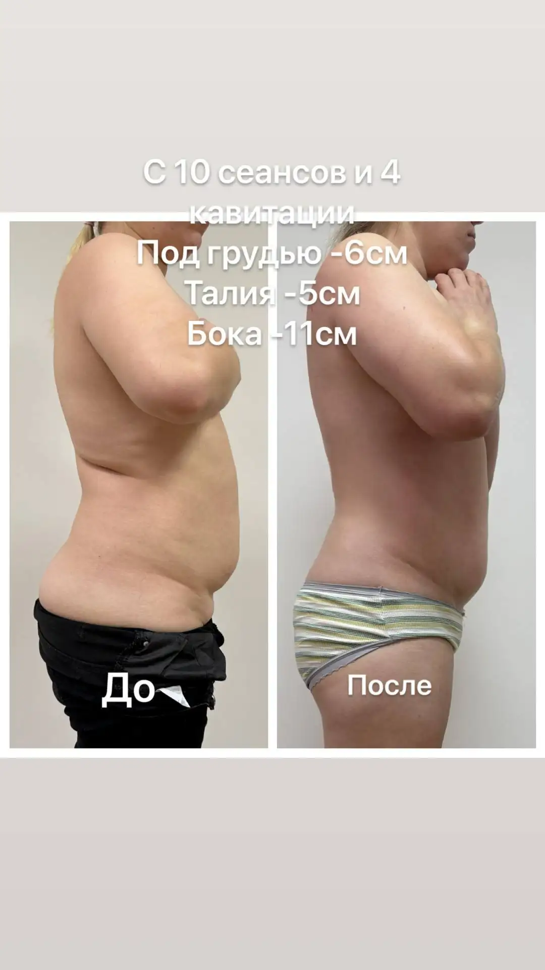 Весеннее преображение: коррекция фигуры и пробные процедуры - Красота и здоровье (Услуги) в Чебоксары