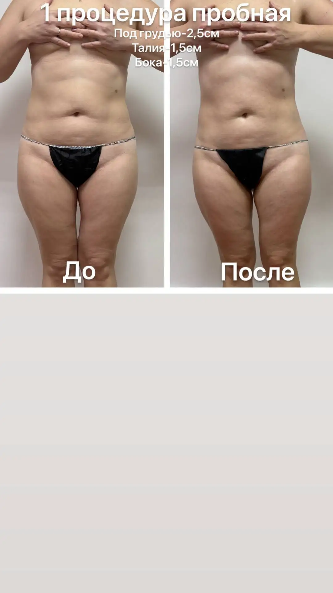 Весеннее преображение: коррекция фигуры и пробные процедуры - Красота и здоровье (Услуги) в Чебоксары