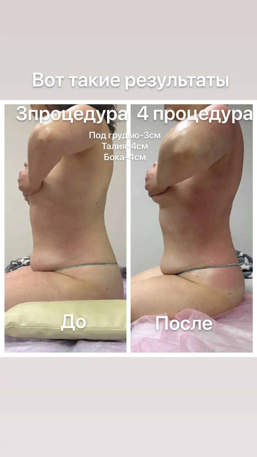 Весеннее преображение: коррекция фигуры и пробные процедуры - Красота и здоровье (Услуги) в Чебоксары