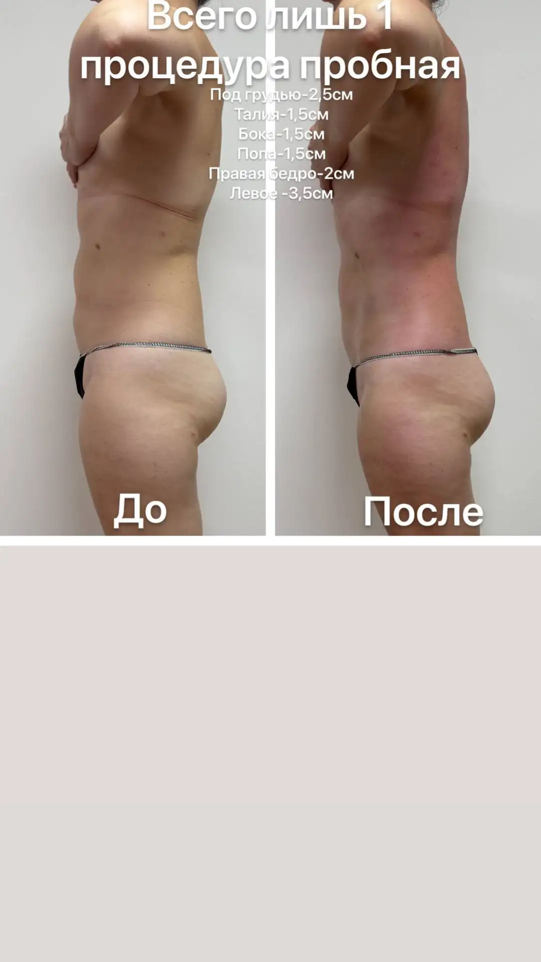 Весеннее преображение к красивой фигуре - Коррекция фигуры (Красота и здоровье) в Чебоксары