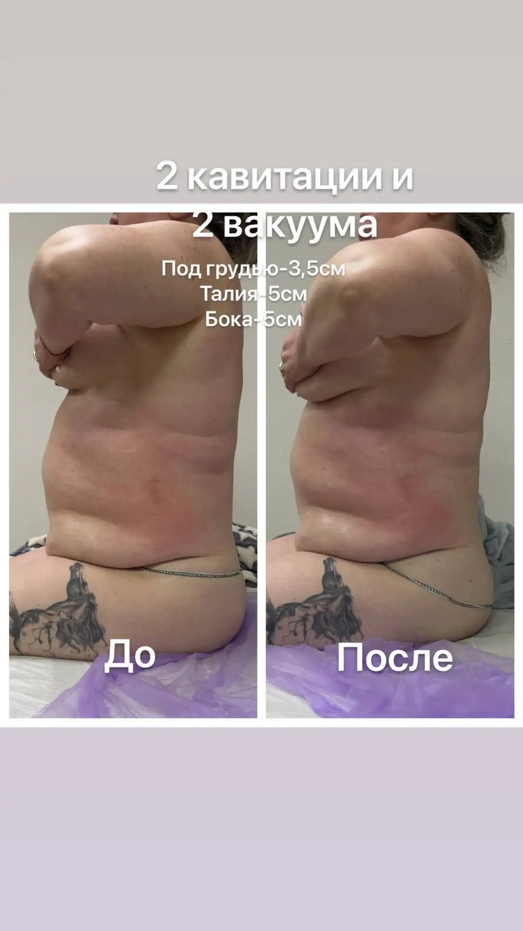 Весеннее преображение к красивой фигуре - Коррекция фигуры (Красота и здоровье) в Чебоксары