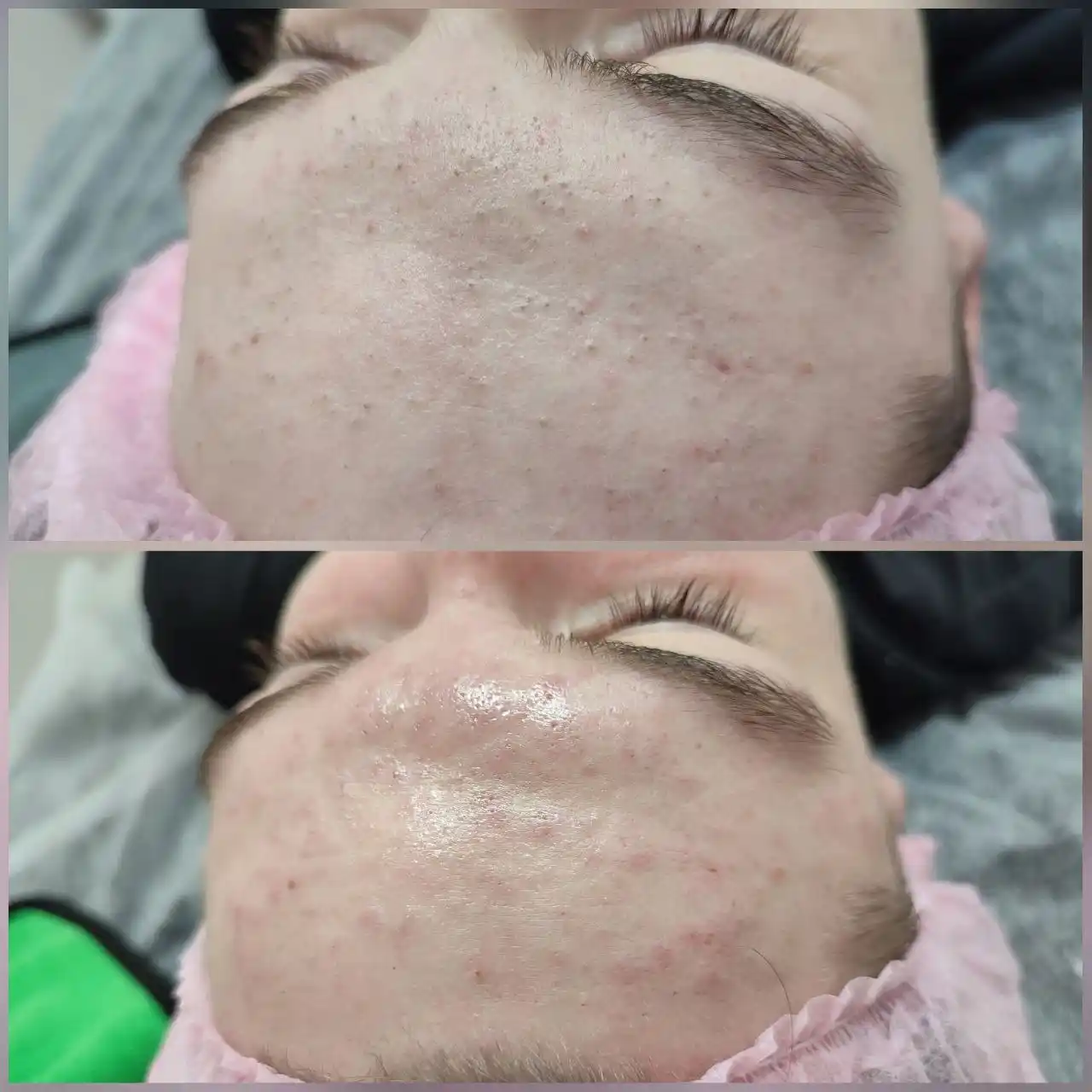 Косметологические услуги в Чебоксарах