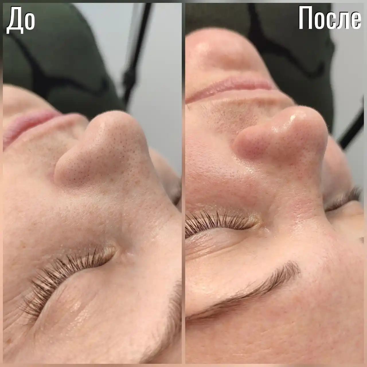 Косметологические услуги в Чебоксарах