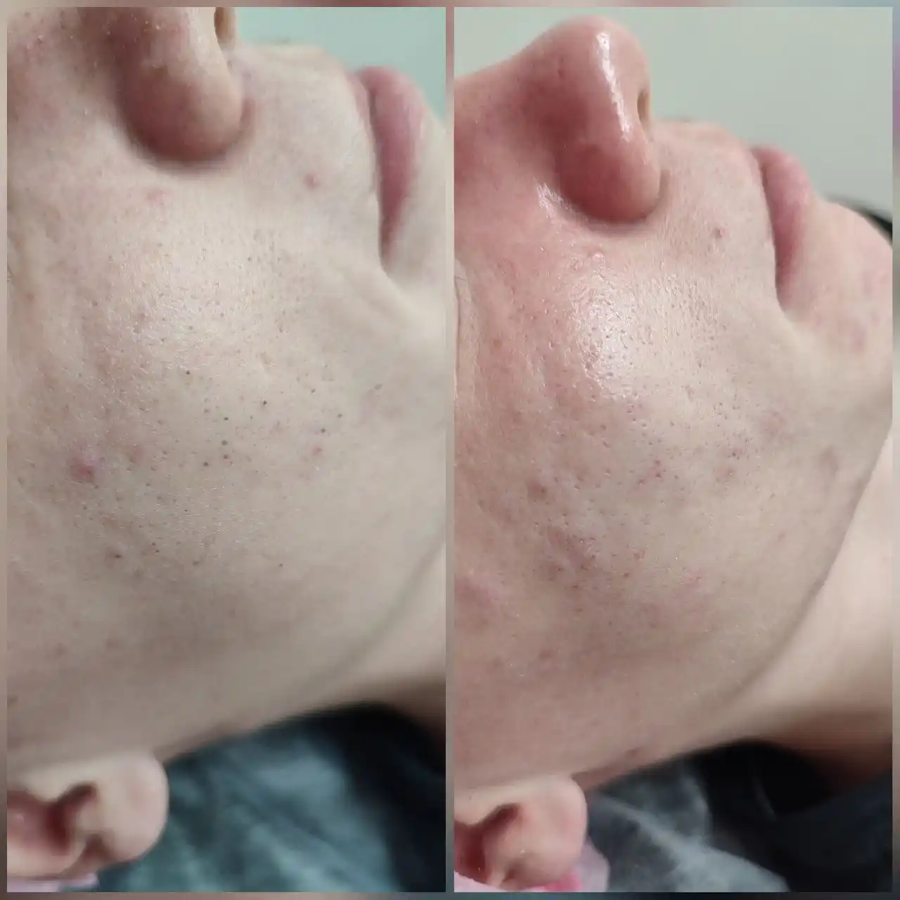 Косметологические услуги в Чебоксарах