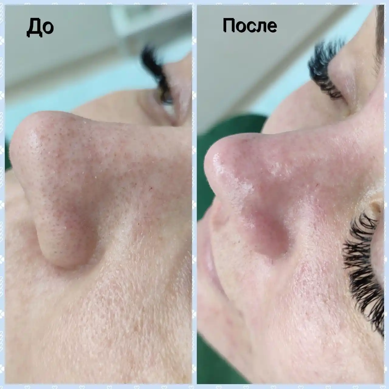 Косметологические услуги в Чебоксарах