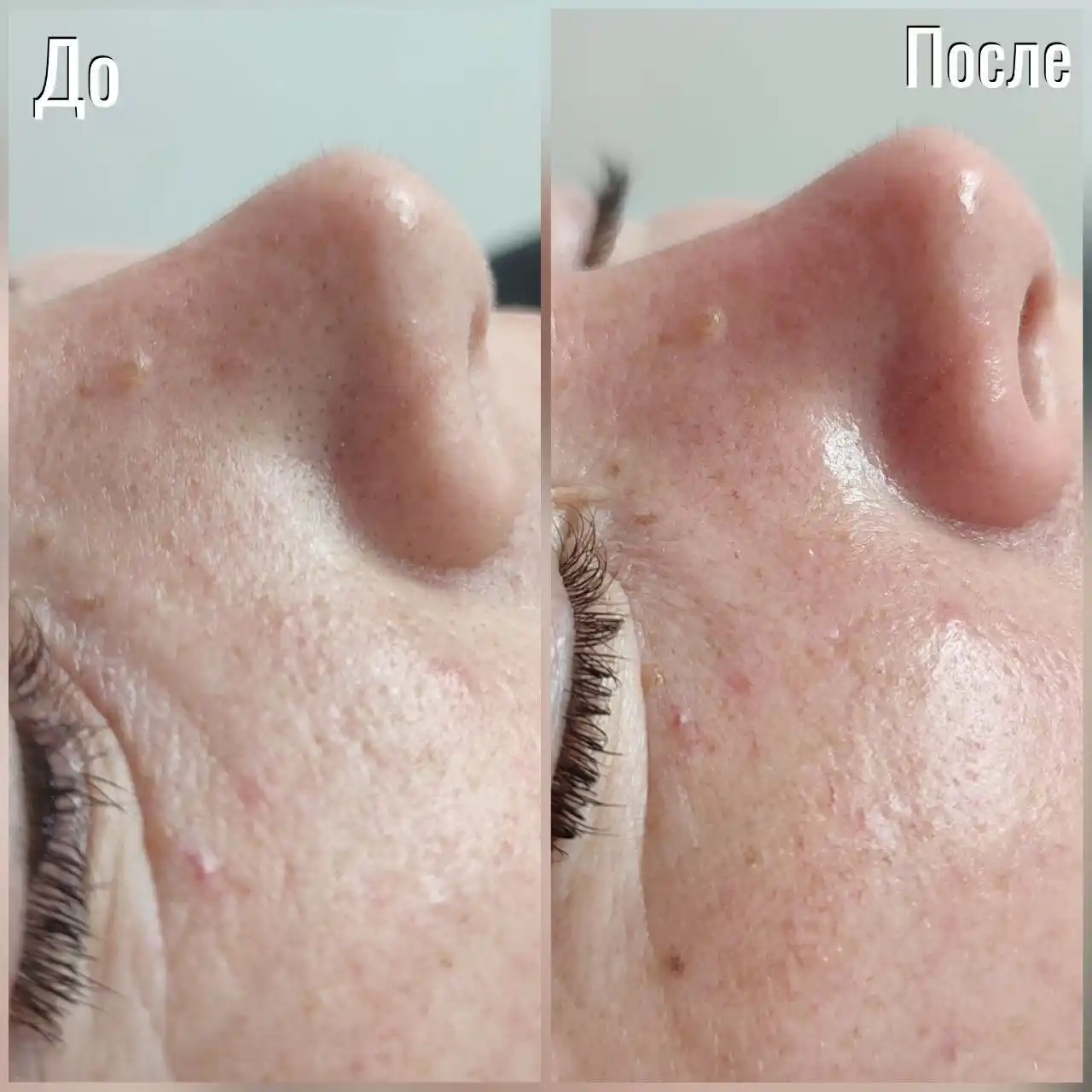 Косметологические услуги в Чебоксарах