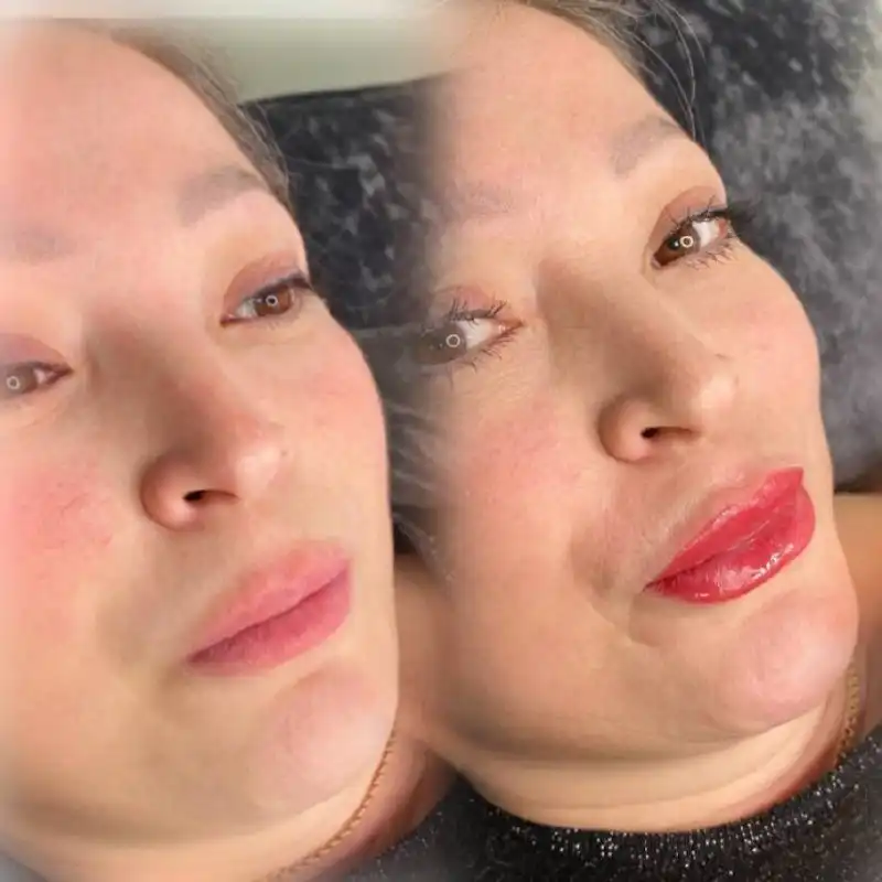 Набор моделей для биоревитализации и перманента губ