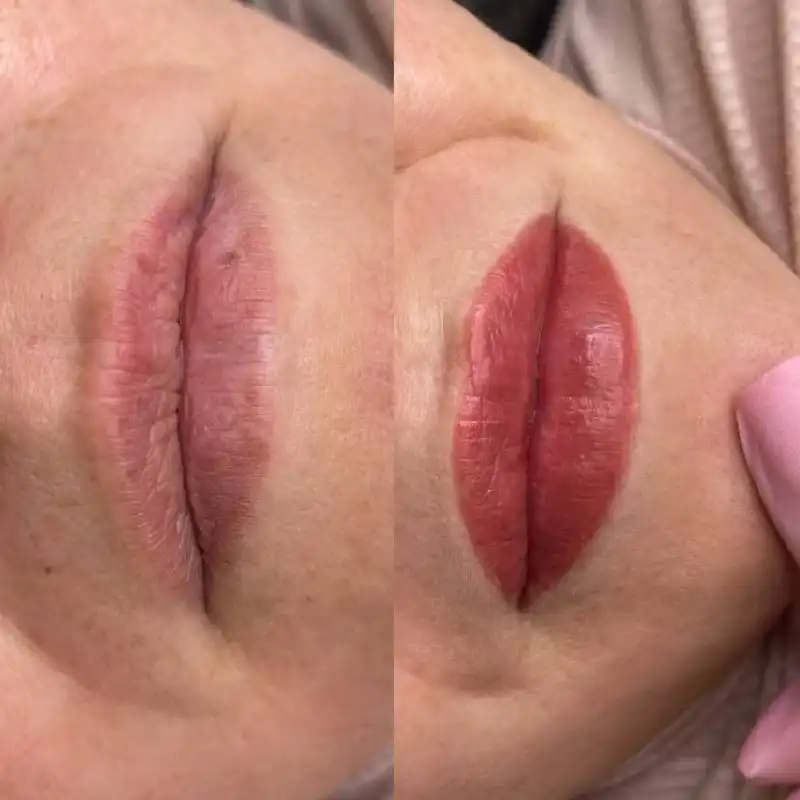 Набор моделей для биоревитализации и перманента губ