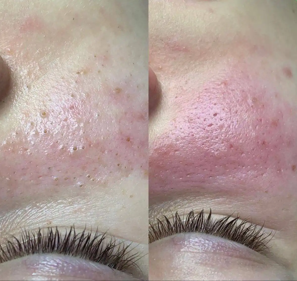 Чистка лица профессиональная косметика GIGI