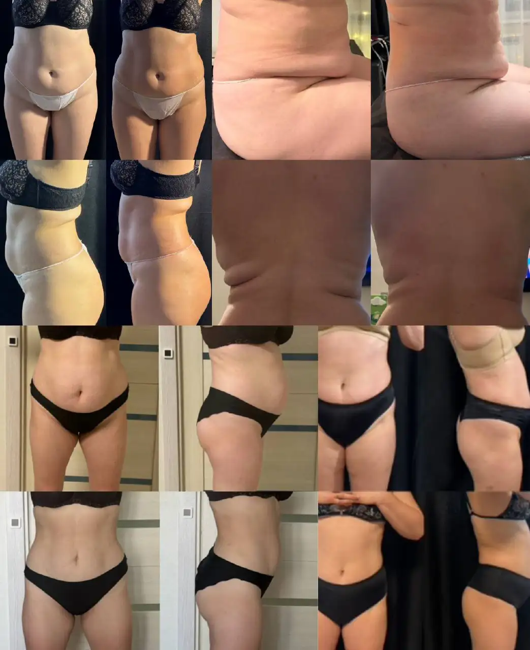 Консультация с пробной процедурой ухода за телом и лицом - Косметологические услуги (Красота и здоровье) в Чебоксары