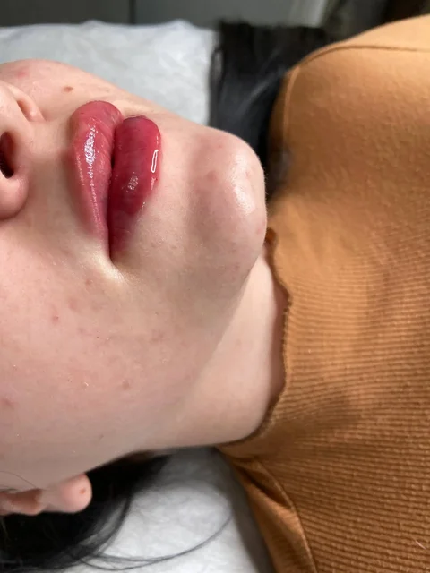 Окошко на сегодня на губки - Барахолка в Нижневартовск