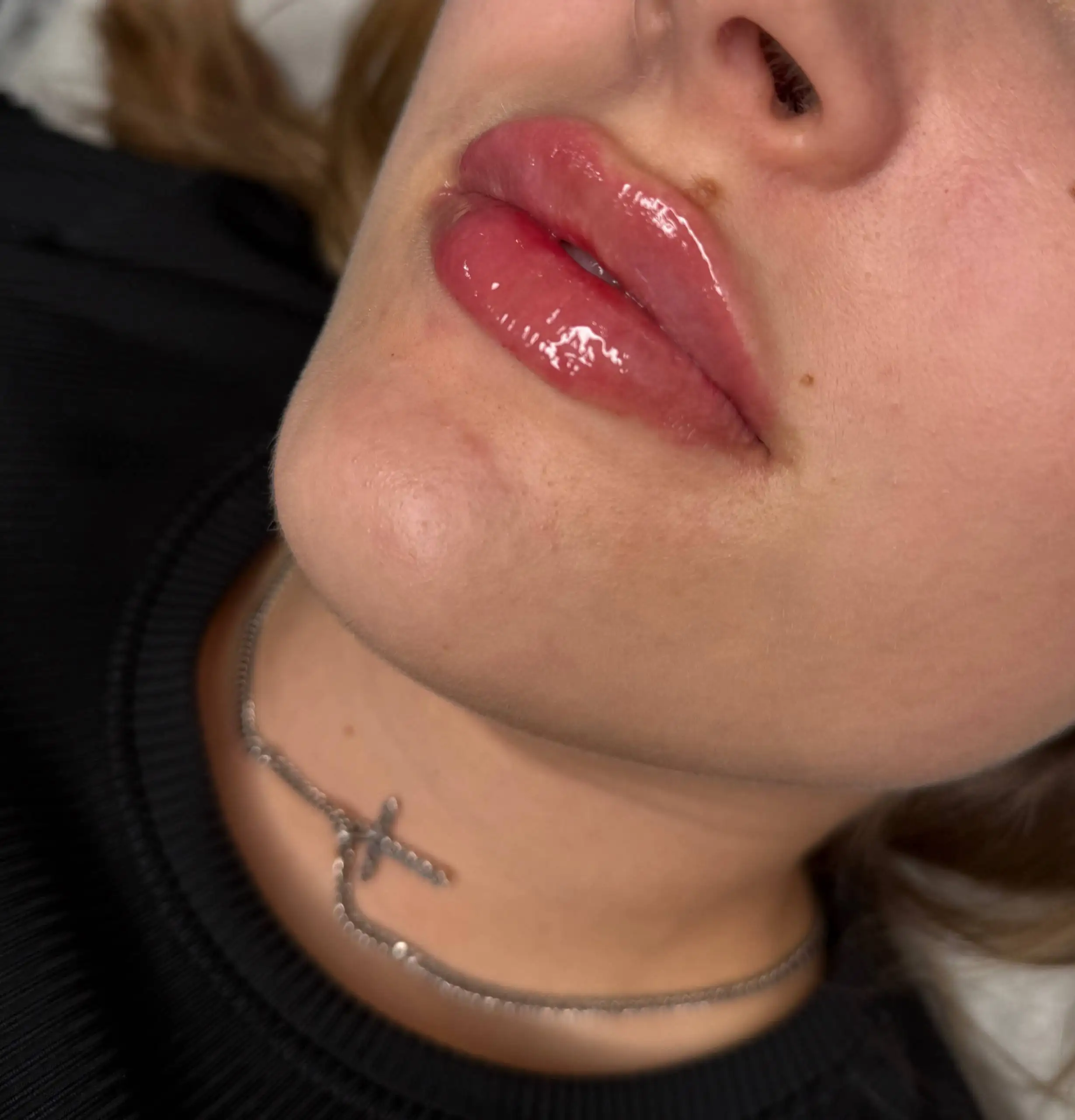 Окошко на сегодня на губки - Барахолка в Нижневартовск