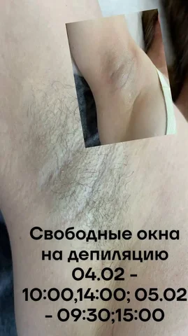 Депиляция на дому - Автоуслуги в Чебоксары