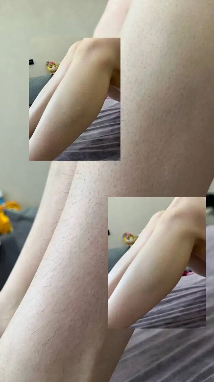 Депиляция на дому - Депиляция (Услуги) в Чебоксары