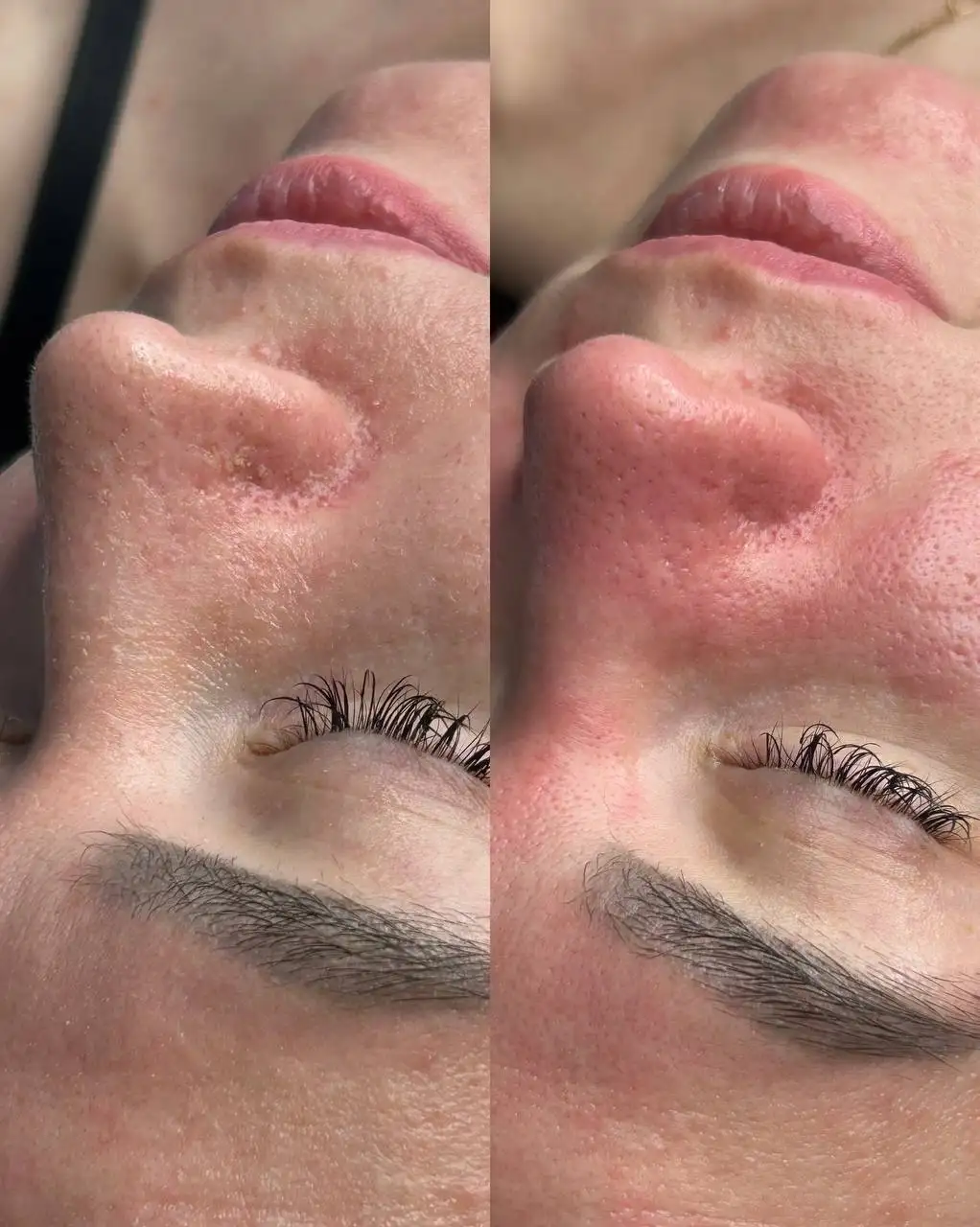 Услуги косметолога с медицинским образованием - Косметология (Услуги) в Ульяновск