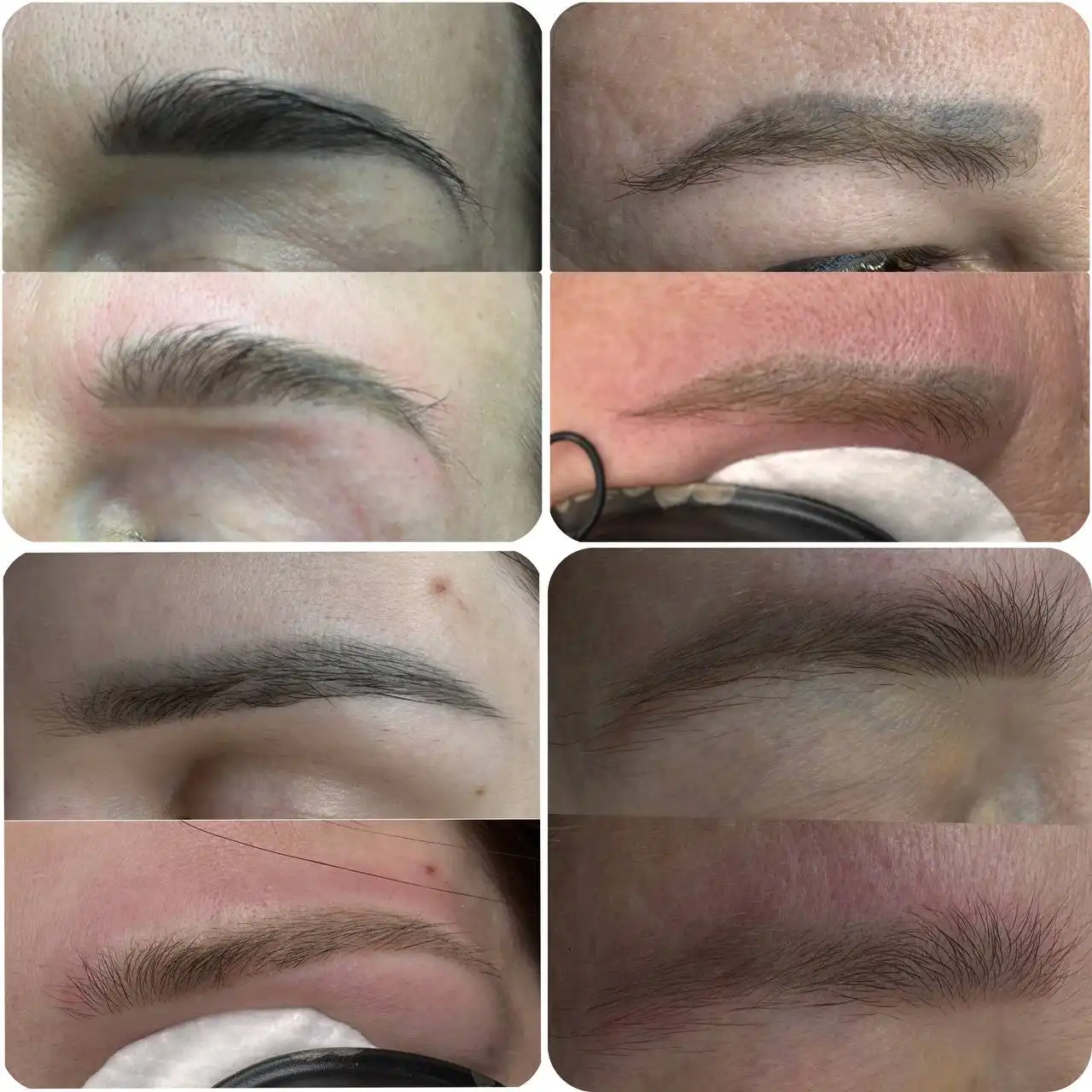 Лазерное удаление перманентного макияжа - Косметология (Красота и здоровье) в Краснодар