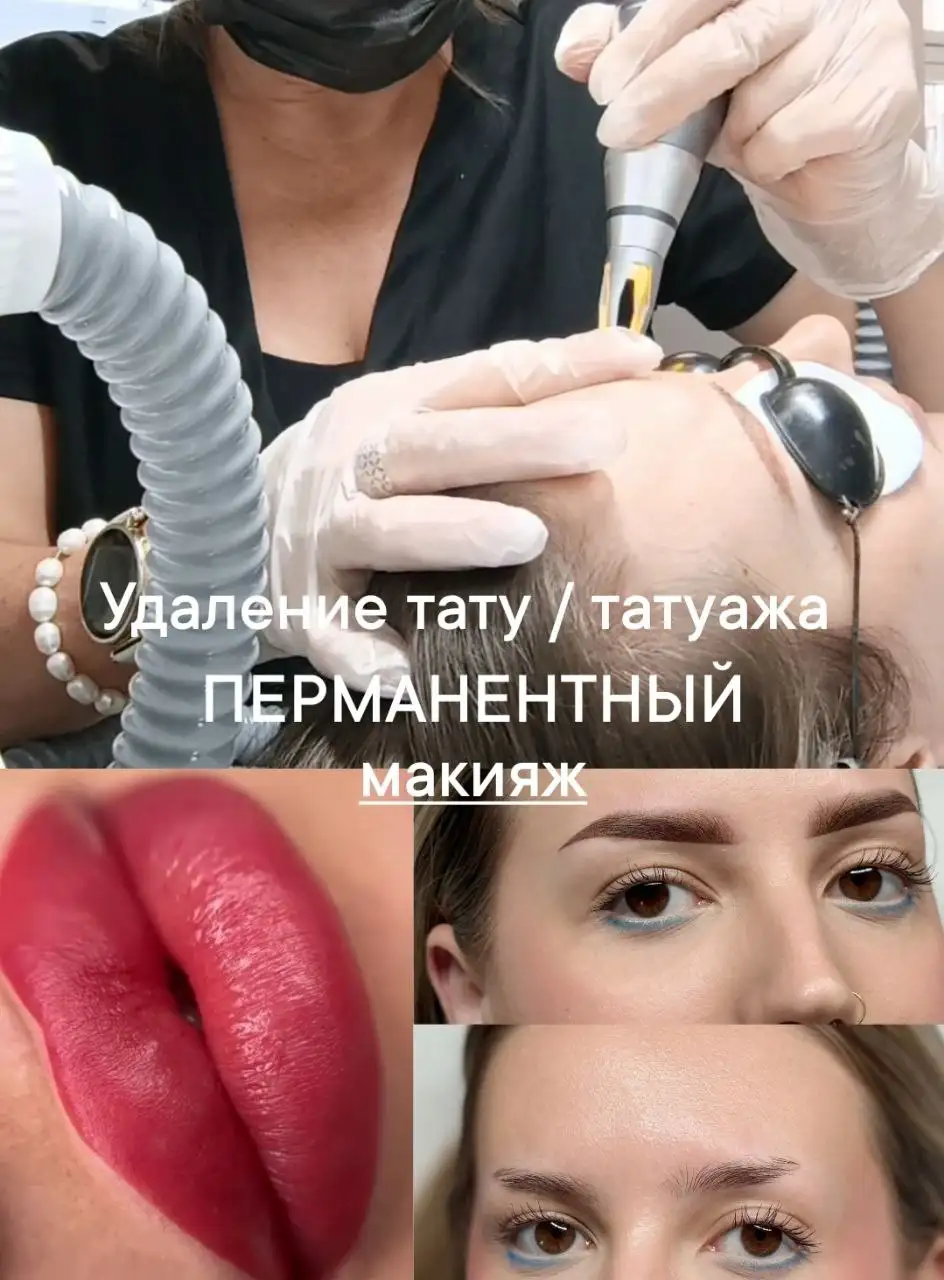 Услуги мастера по удалению тату и перманентного макияжа - Красота и здоровье (Услуги) в Краснодар