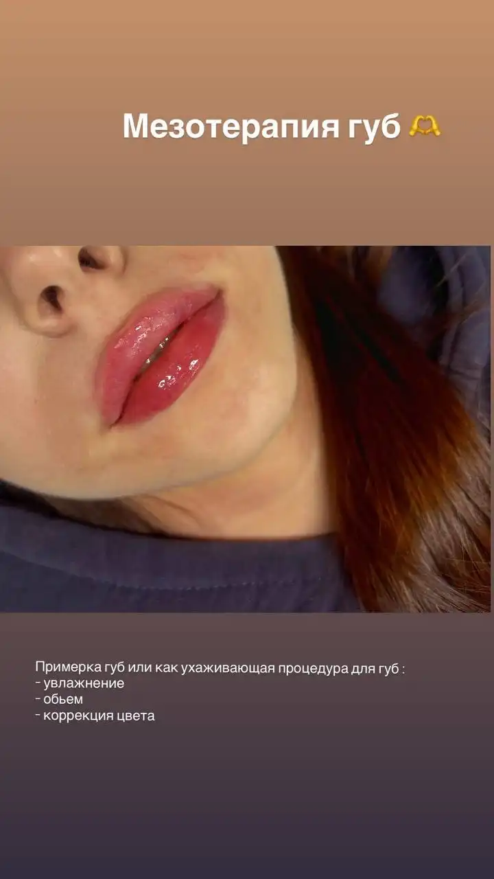 Зимние предложения на косметологические процедуры от косметолога с медицинским образованием - Косметология (Красота и здоровье) в Самара