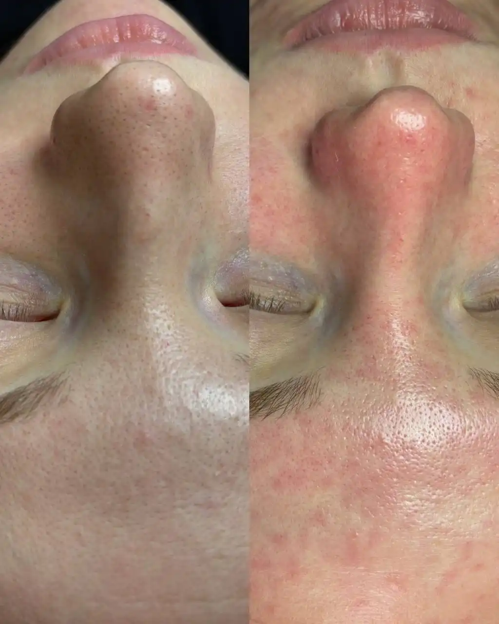 Зимние предложения на косметологические процедуры от косметолога с медицинским образованием - Косметология (Красота и здоровье) в Самара