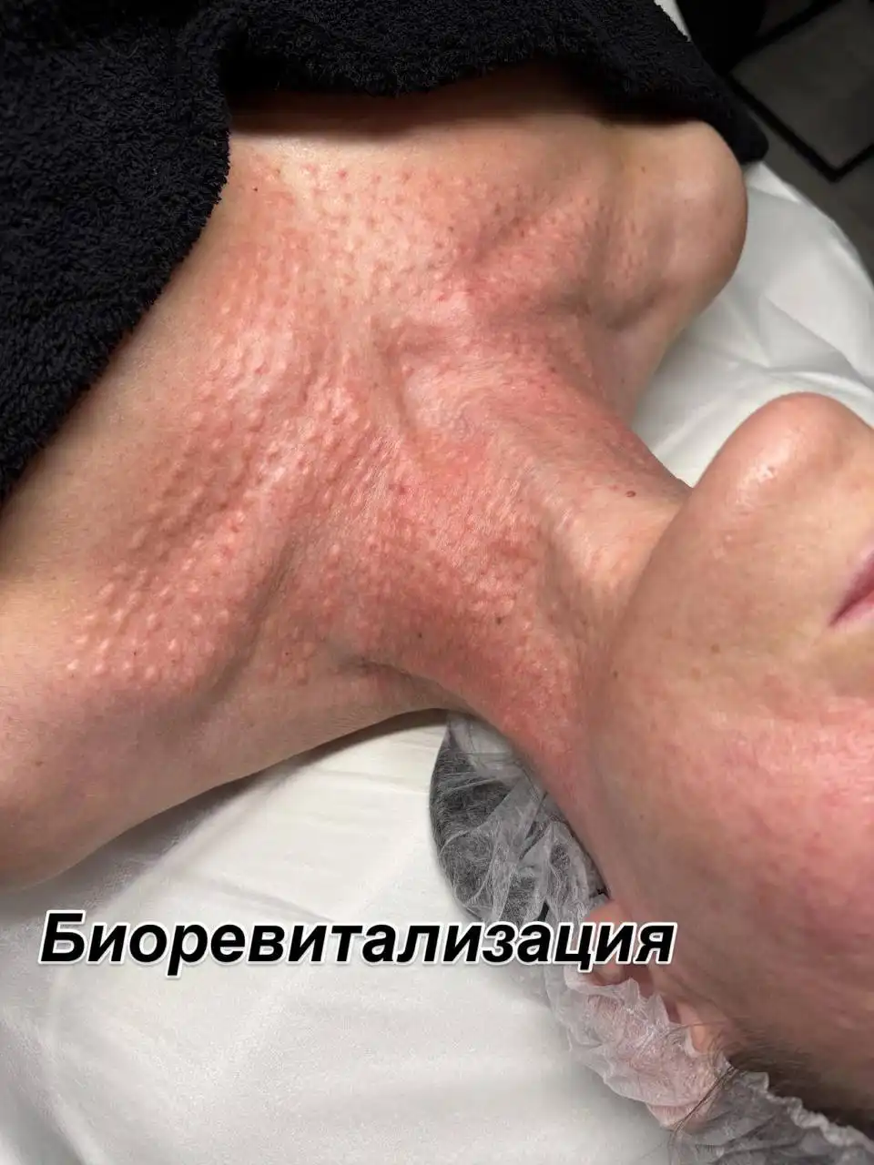 Зимние предложения на косметологические процедуры от косметолога с медицинским образованием - Косметология (Красота и здоровье) в Самара