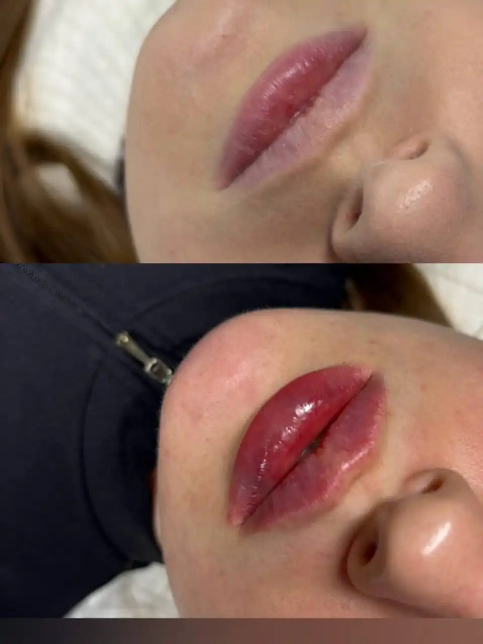 Зимние предложения на косметологические процедуры от косметолога с медицинским образованием - Косметология (Красота и здоровье) в Самара