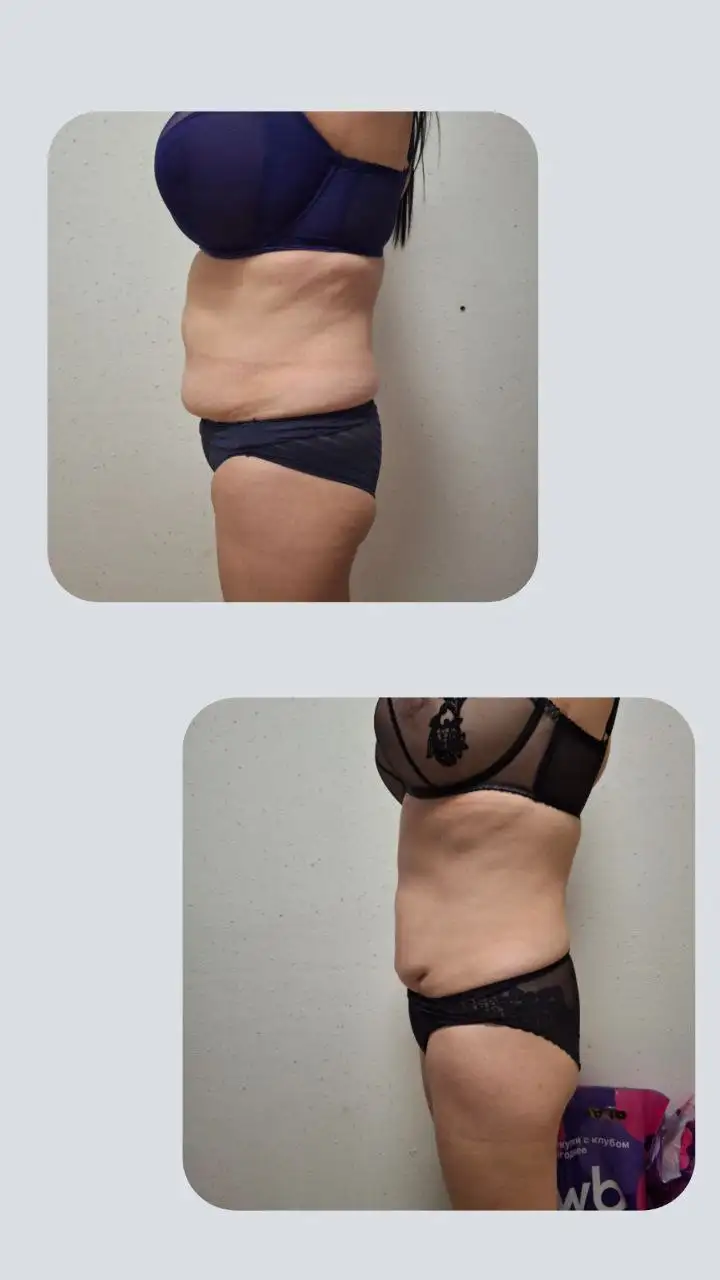 Косметологические процедуры в Самаре - Косметология (Услуги) в Самара