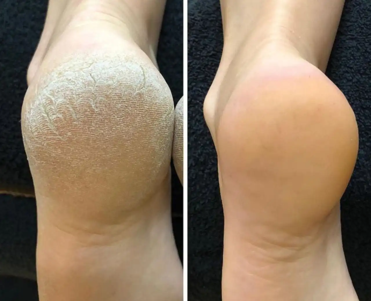 Салон красоты Малина в Петра Дубраве - Салон красоты (Красота и здоровье) в Петра Дубрав