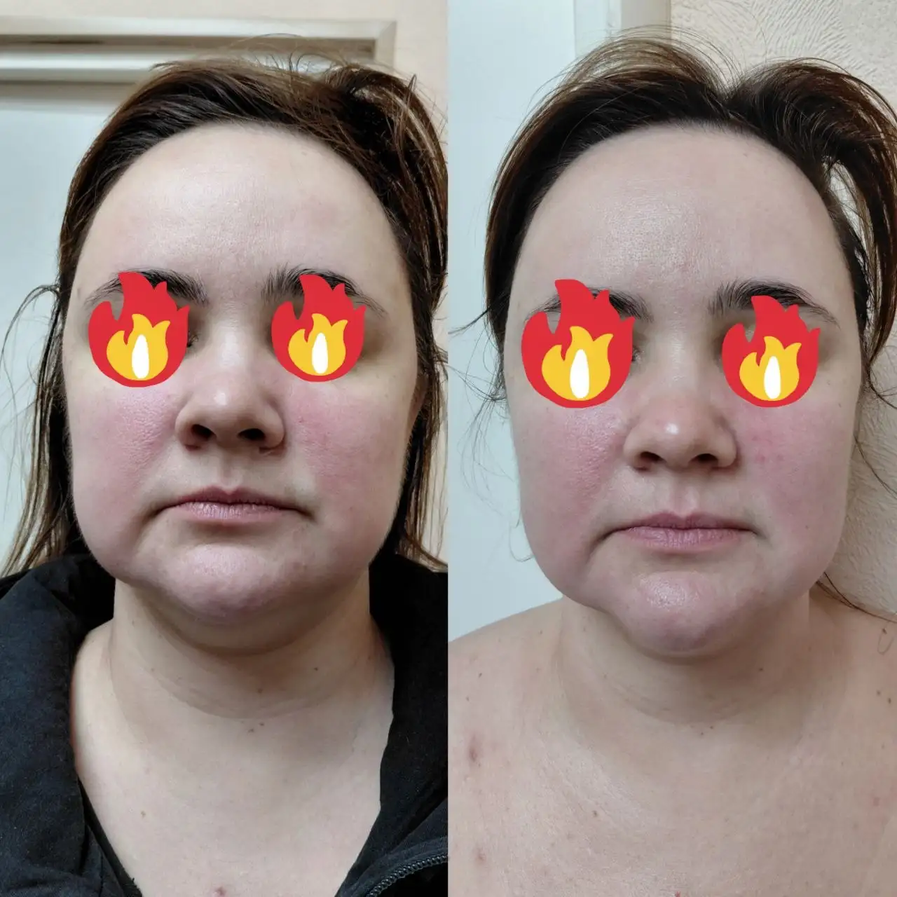 Авторский массаж лица от косметолога с медицинским образованием - Массаж лица (Красота и здоровье) в Самара