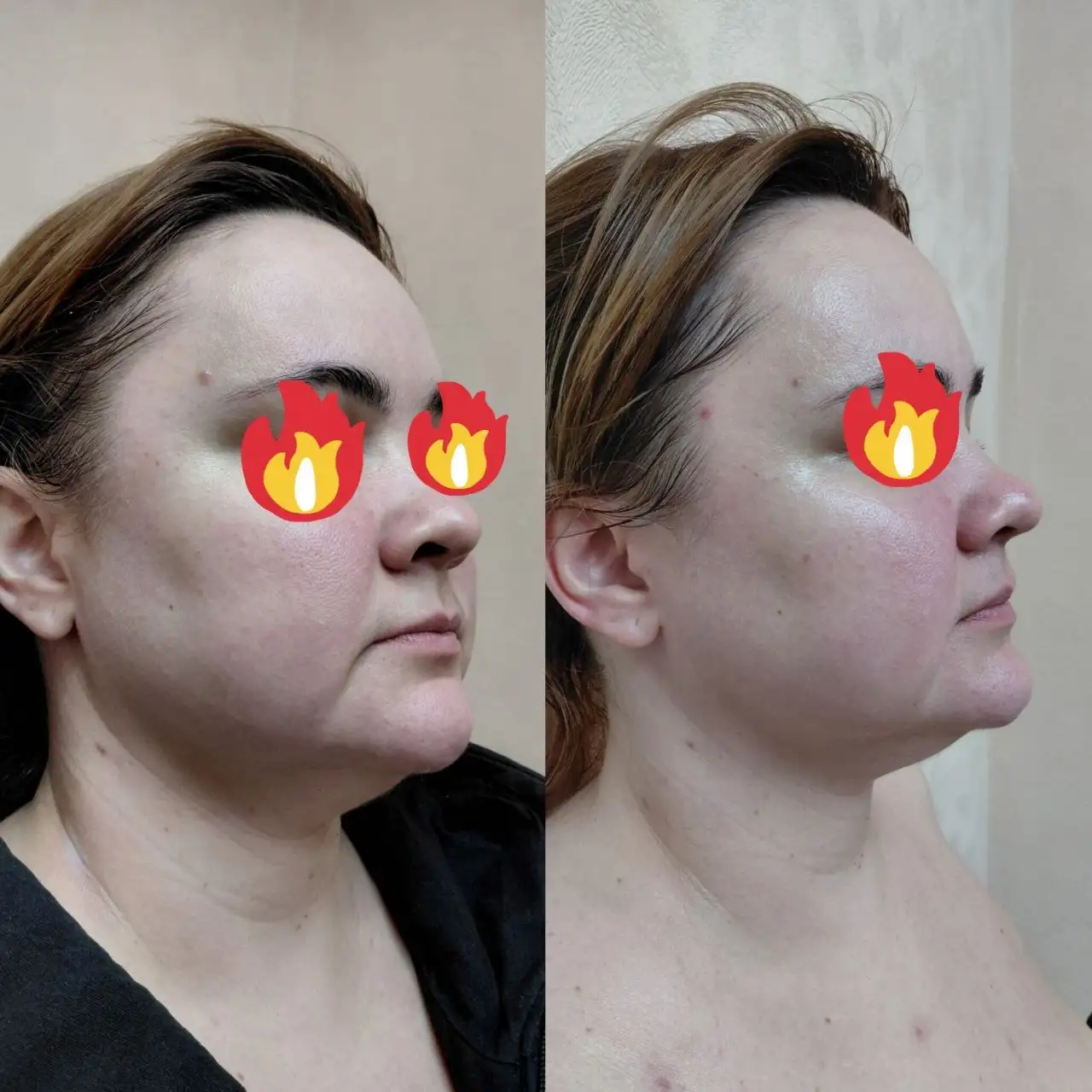 Авторский массаж лица от косметолога с медицинским образованием - Массаж лица (Красота и здоровье) в Самара