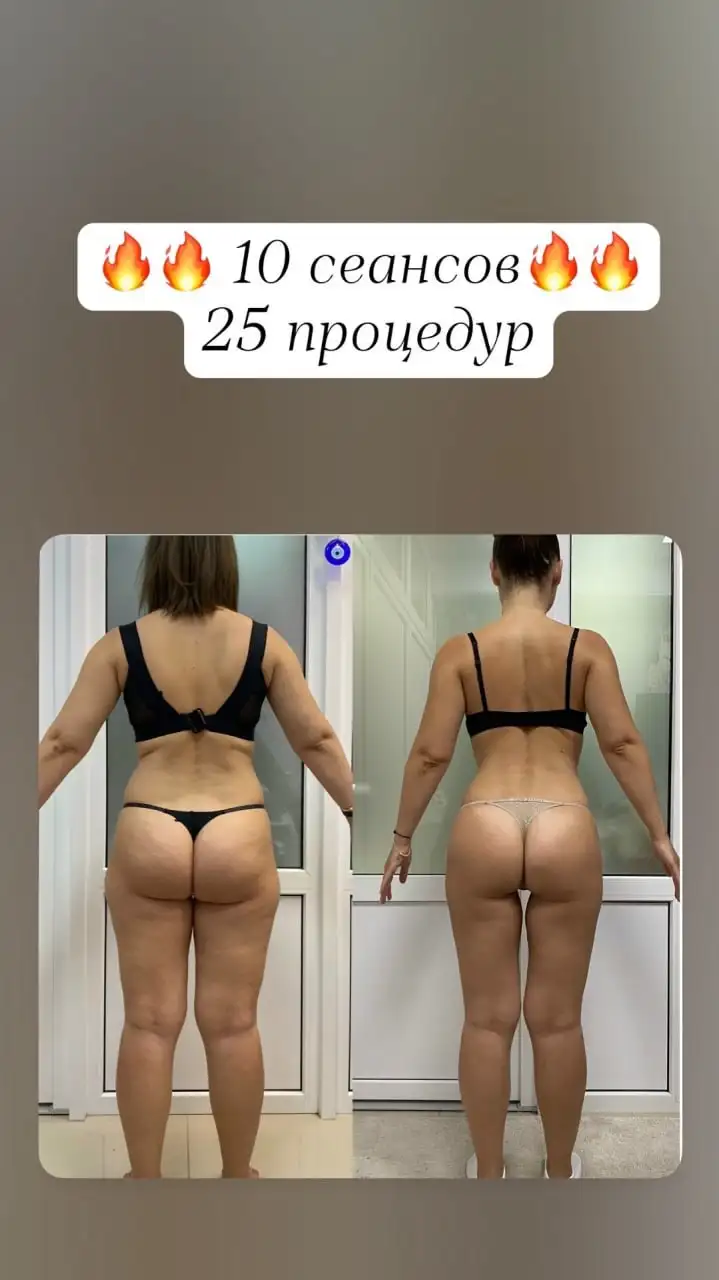 Массаж, обертывание, пеленания - Услуги в Самара