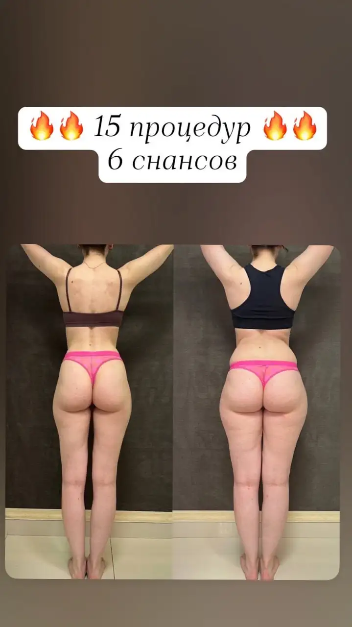 Массаж, обертывание, пеленания - Услуги в Самара
