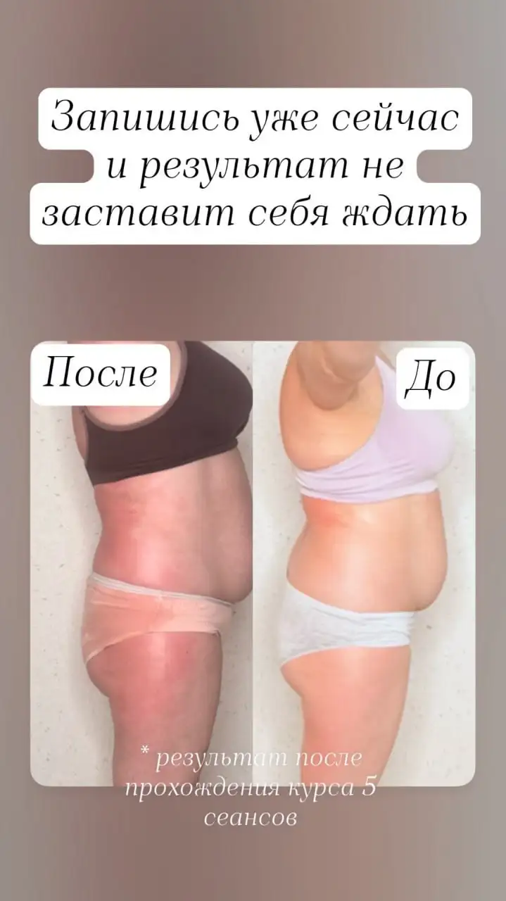 Массаж, обертывание, пеленания - Услуги в Самара