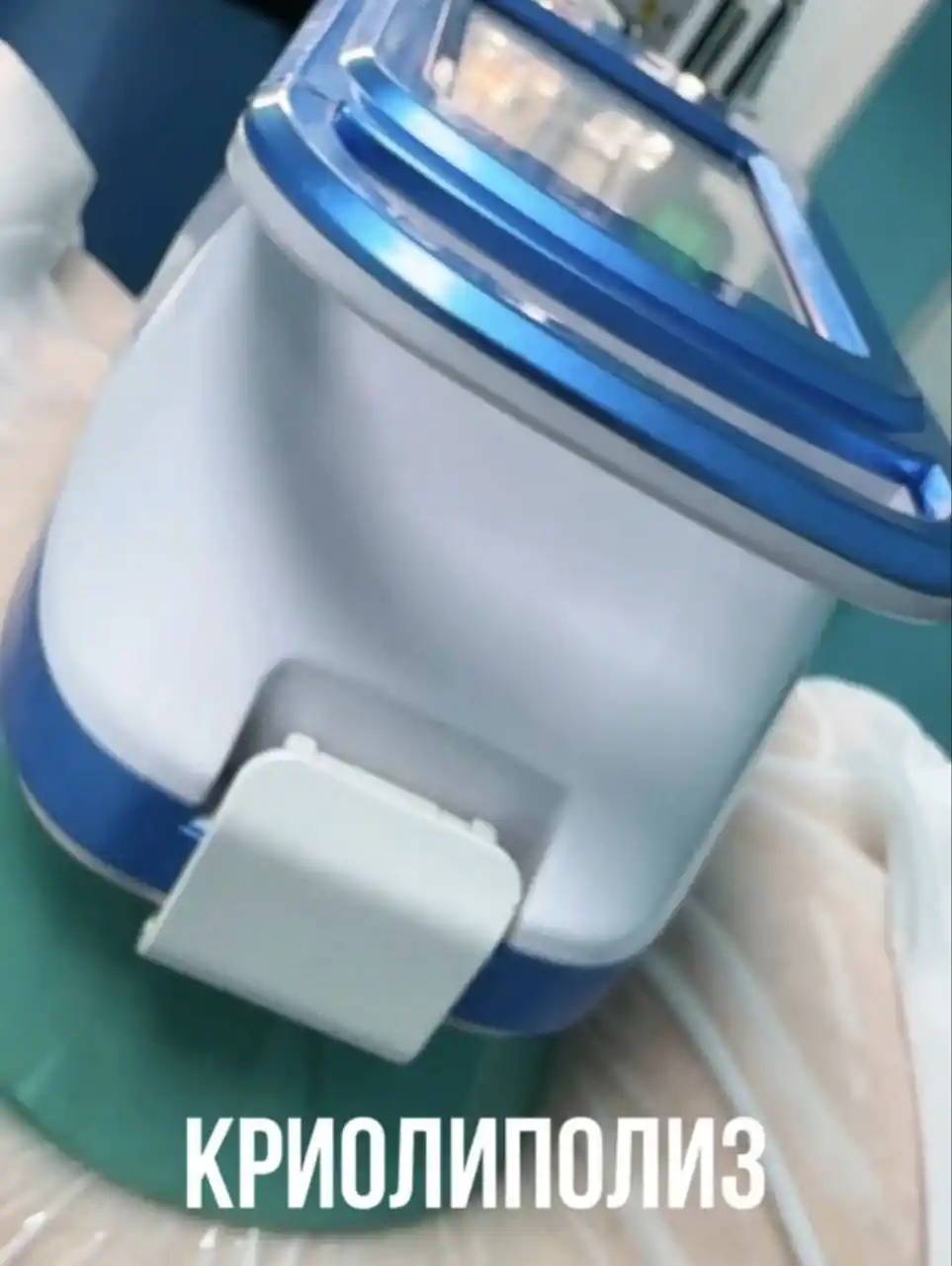 Криолиполиз для коррекции фигуры