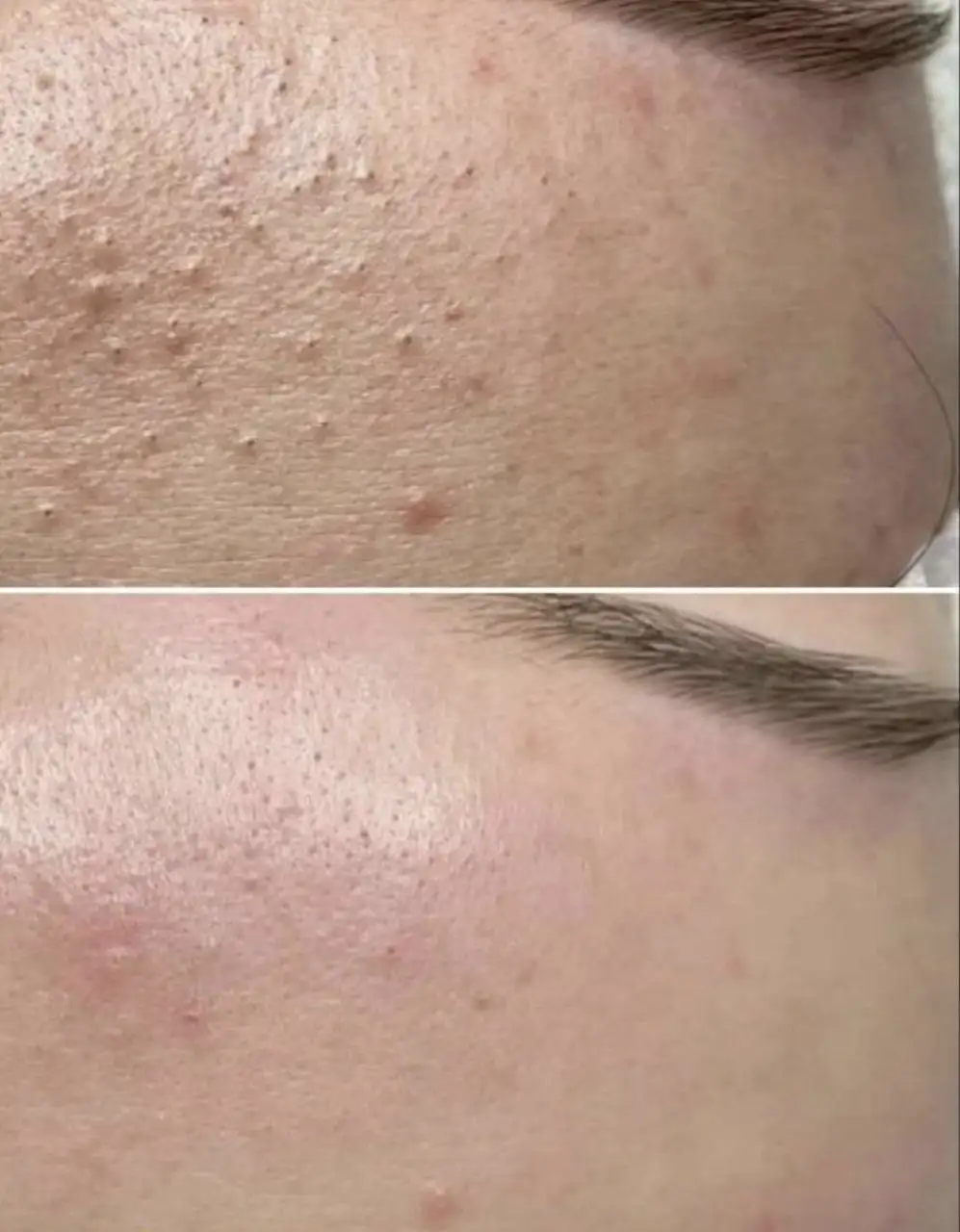 Профессиональная чистка лица в Оренбурге - Косметология (Услуги) в Оренбург