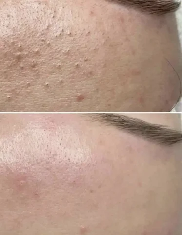 Профессиональная чистка лица в Оренбурге - Косметология в Оренбург