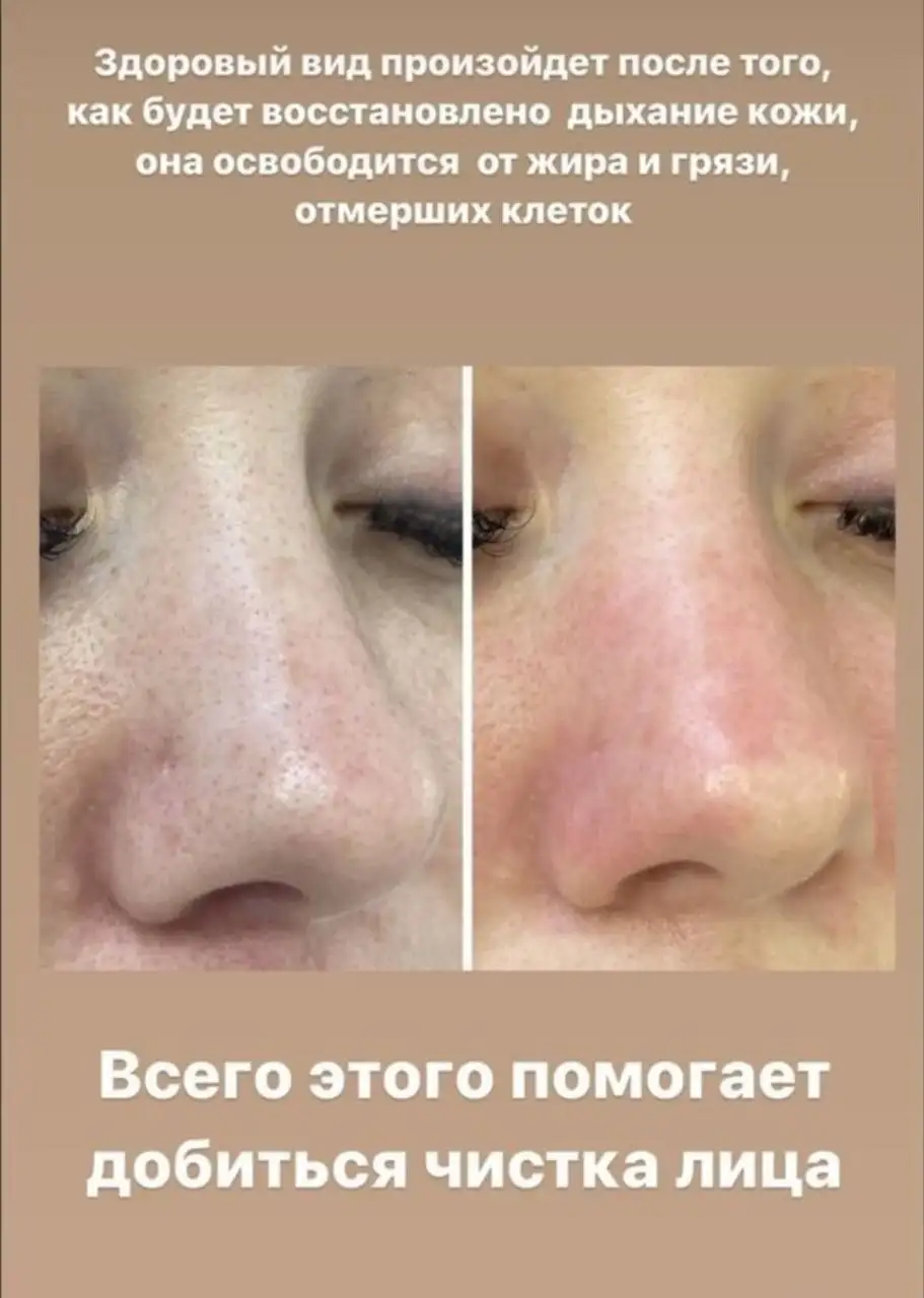 Услуги косметолога в Саратове - Косметология (Услуги) в Саратов