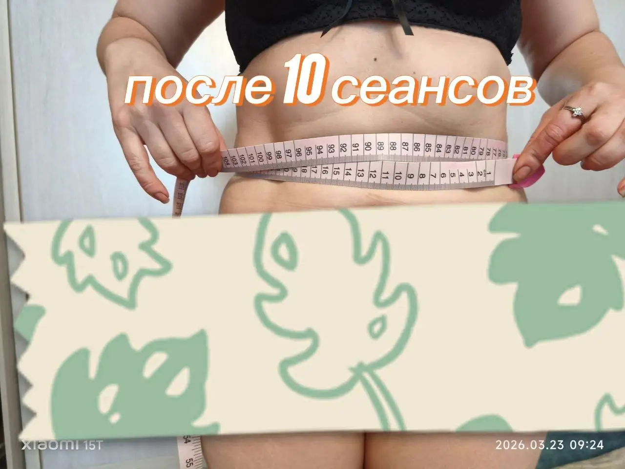 Услуги эстетической косметологии в Саратове - Косметология (Услуги) в Саратов