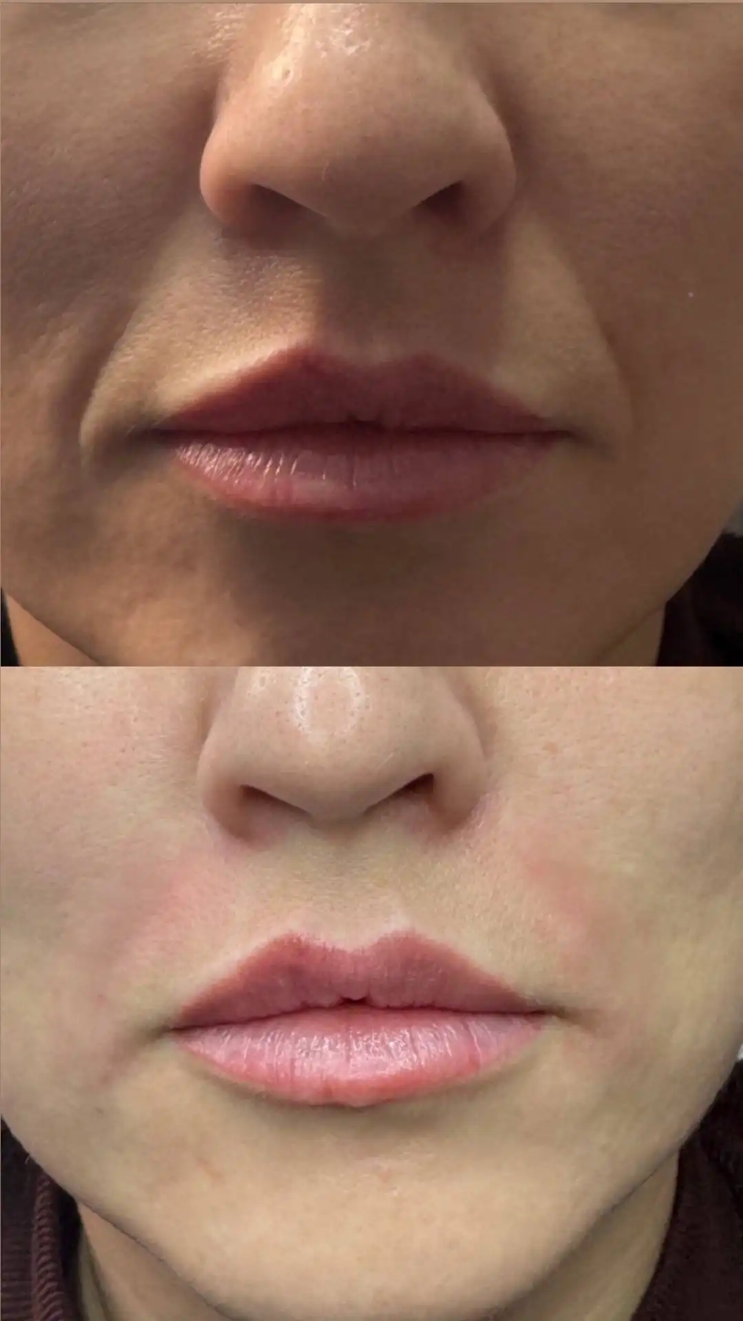 Косметолог в Новосибирске - Косметология (Услуги) в Новосибирск