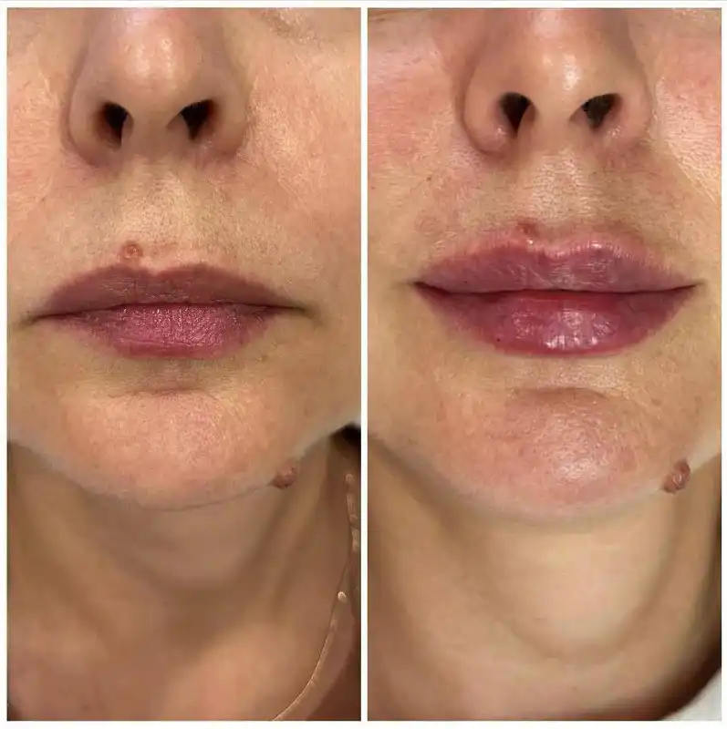 Косметолог в Новосибирске - Косметология (Услуги) в Новосибирск