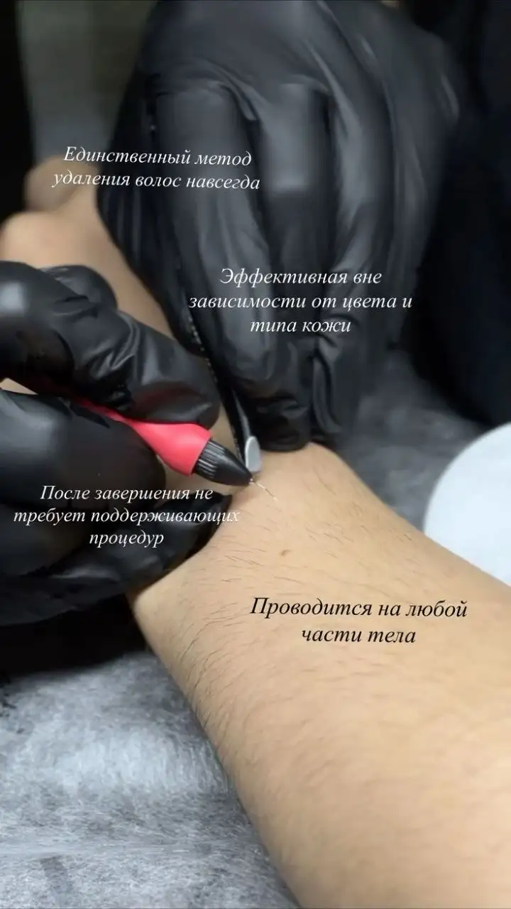 Электроэпиляция - удаление волос навсегда - Электроэпиляция (Красота и здоровье) в Тюмень