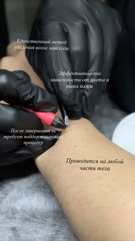 Электроэпиляция - удаление волос навсегда - Спа и массаж в Тюмень