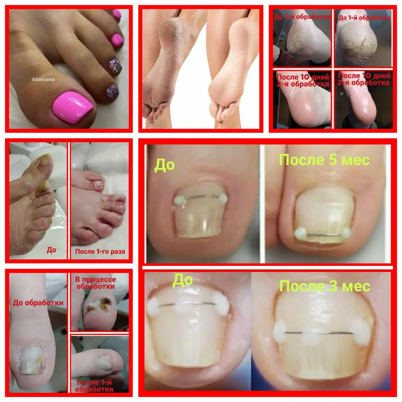 Профессиональный смарт-педикюр для проблемных стоп и ногтей в Чите - Красота и здоровье (Услуги) в Чита