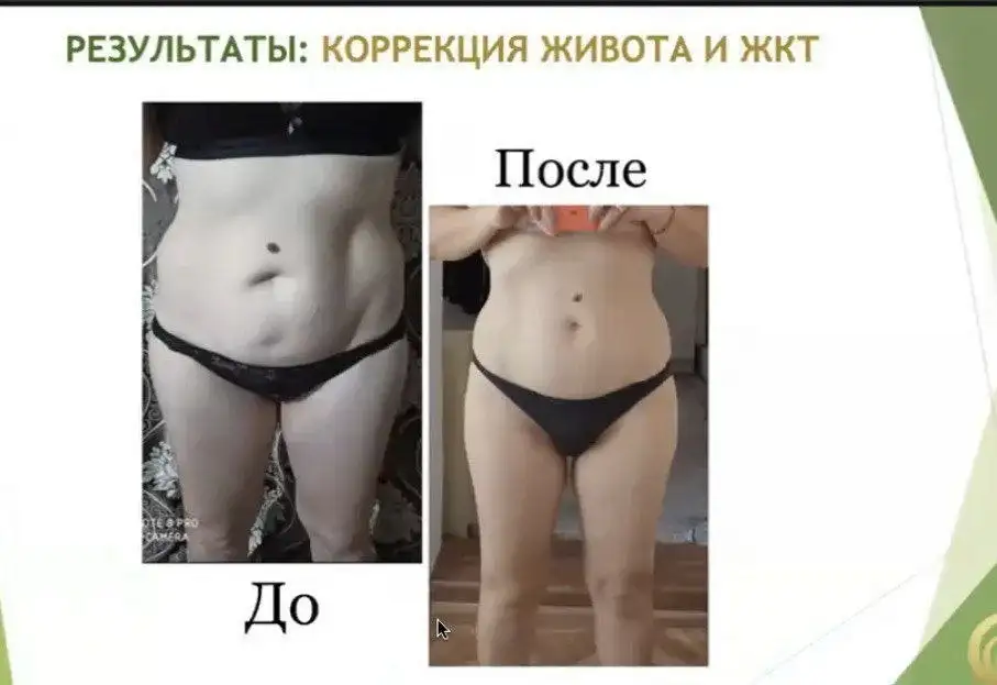 Массаж живота в Чите - Массаж (Услуги) в Чита