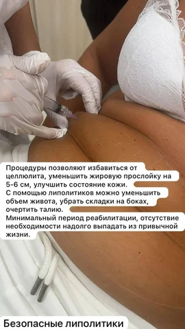Липолитики - Красота и здоровье в Сургут