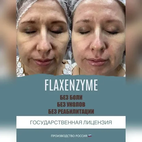 Умный фитнес для лица - Косметика в Сургут