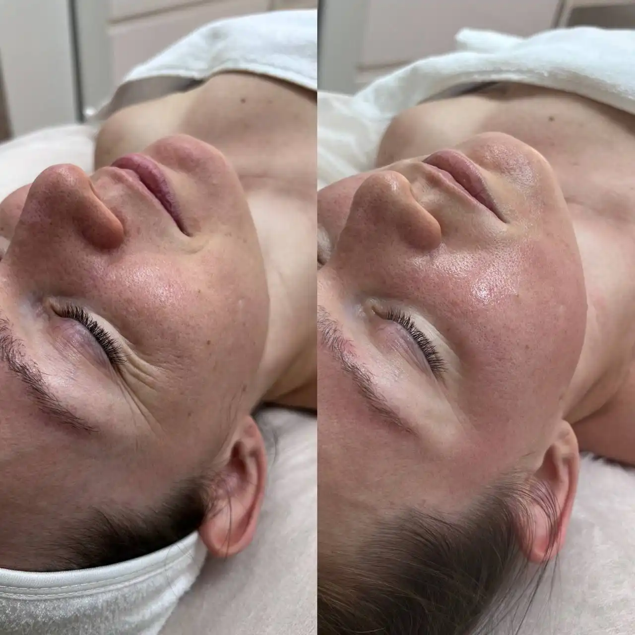 Глубокотканый массаж лица в клинике доктора Князева - Массаж лица (Красота и здоровье) в Сургут